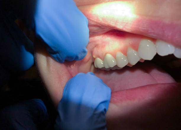 Best Weekend Emergency Dentist in Craigsville, WV