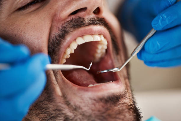 Best Emergency Treatment for Toothache in Craigsville, WV